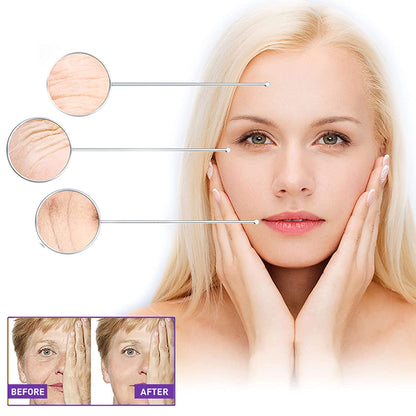 Set Masca Facialai Lifting, 60 bucati